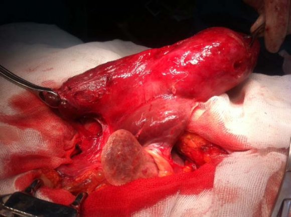Figure 3 : Extracted Specimen III.