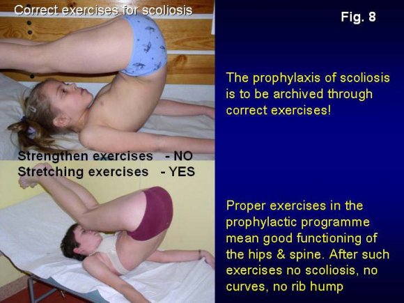Figure 13 : Results after new exercises for scoliosis