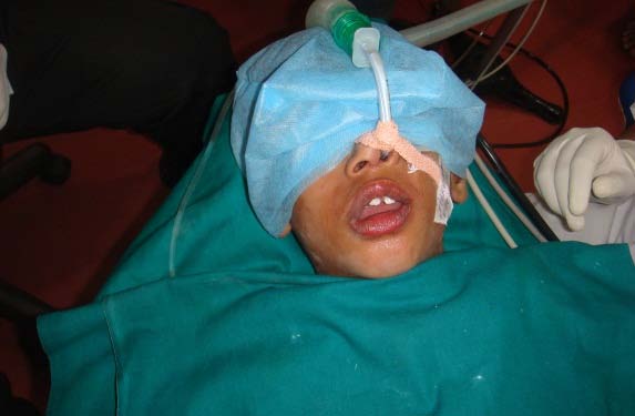 Figure 6 : Postoperative
