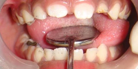 Figure 8 : Preoperative