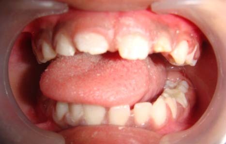 Figure 9 : Post-operative