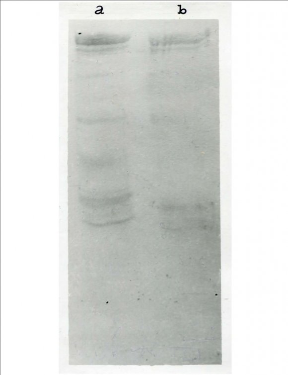 Figure 2 : Protein carbonyl content of human erythrocyte ghostIncubation of erythrocyte ghosts was carried out at 37ºC for 2 h with or without addition of FeSO 4 (0.2 mM) and ascorbate (0.5 mM) in presence or absence of mannitol (20 mM), DMSO (20 mM) and catalase (50 ?g/ml) and protein carbonyl content was measured as described in the methods. Results presented were mean ± SEM of 10 observations (N=10) followed by Student's 't' test (paired). Value of II was significantly higher than the value of I; where, IIp < 0.001. Values of III, IV and V, marked with asterisks (*) indicated statistically significant inhibition with respect to the value of II; where *p < 0.001.