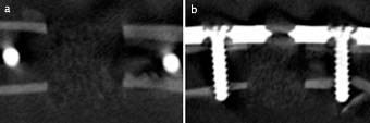 Year 2015 and connective tissue, in all the animals (see Fig3 and 4). It was always positioned correctly in the osteotomic