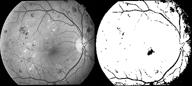 Fig. 5 : (a) original Image