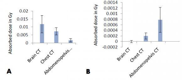 Figure 7: The absorbed dose in Gy. A. For thyroid gland, and B. for gonad