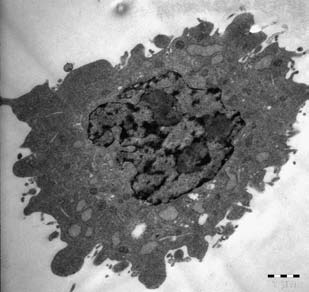 Figure 3 : TEM observations of SH-SY5Y cells after exposure to CuO-NPs. (a) cells exposed to CuO-NPs at 2.5 µg/mL; (b) cells exposed to CuO-NPs at 10 µg/mL; (c) unexposed cell (negative control).