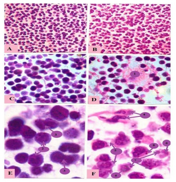 Figure 1: In vitro cytotoxic effect of ethanol extract of combination of Punica grantum L and Ziziphus mauritiana on EAC cells. ZP (E): Ethanol extract of combination of Punica grantum L and Ziziphus mauritiana