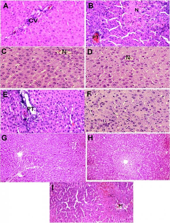 04 and 40.3 units/mL, for ALT, AST, ALP, bilirubin and cholesterol levels respectively. Results for histopathological examination are given in Figures 2 & 3. Volume XVII Issue II Version I © 2017 Global Journals Inc. (US) Aralia racemosa L. and its Triterpenoid and Steroid Compounds against Paracetamol -Induced Liver Injury in Albino Wistar Rat