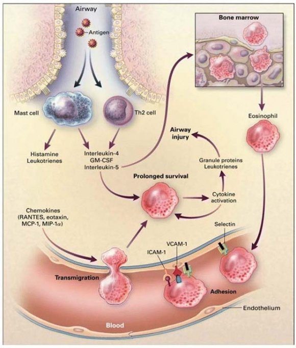 Figure 1-2 : Airway inflammation (Cohn et al., 2004). Vascular-cell adhesion molecule 1 (VCAM-1) Intercellular adhesion molecule 1 (ICAM-1) Granulocyte-macrophage colony-stimulating factor (GM -CSF) Monocyte chemotactic protein (MCP-1) Macrophage inflammatory protein (MIP-1?)