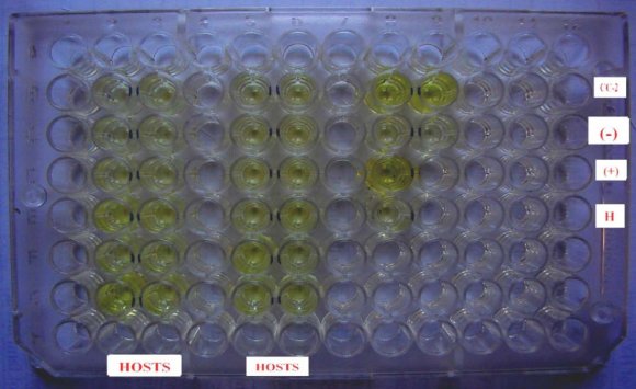 Symptoms of Isolates under Field Conditions Collected From Different Localities of Solan District d) Transmission i.