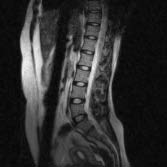 Figure 3 : Comparison of vertebrae features of cervical vertebrae