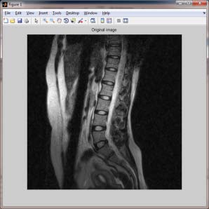 Figure 5 : Relation between lumber vertebrae properties