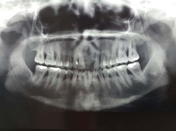 Figure 2 : Whatmann absorbent papers.
