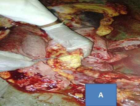 Figure 2 : Mean severity of lesion in lung and different lymph nodes.