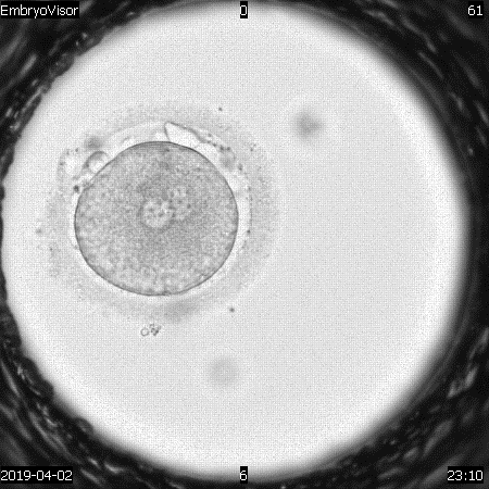 Figure 1: Human embryo of the 1st day of development at the 2PN2PB stage (zygote), magnification 200X.