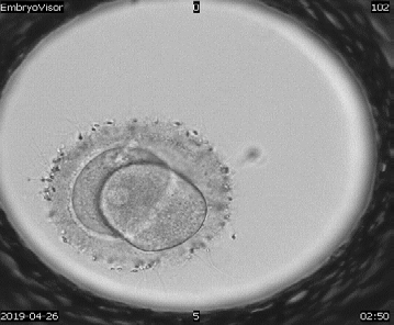 Figure 4: Reverse cleavage of 2-4-2 embryos, magnification 200X.
