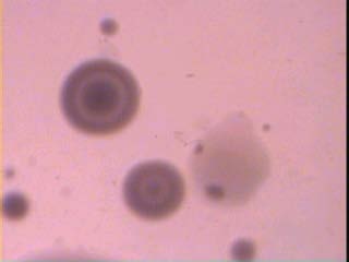 Figure 2: The fried egg colonies of M.genitalium on modified PPLO medium (X 160)