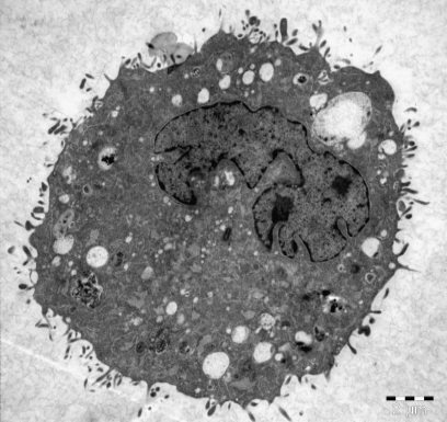Figure 2 : The TEM images and size distributions of CuO-NPs after dissolution in water (a) and cell culture medium (b).