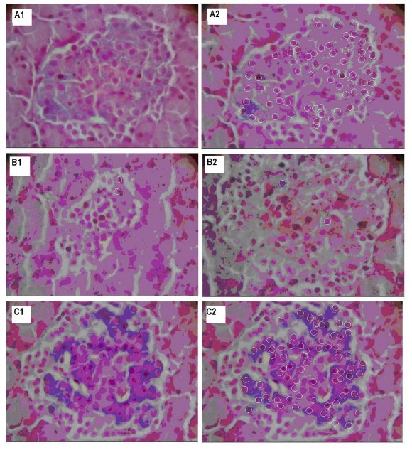 Figure 1 : Regression line of serum iron and malondialdehyde in miscarriage women.