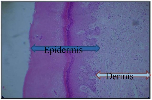 Figure 2 : Photomicrograph of skin tissue from Group II showedmild hyperkeratosis in the epidermis(black arrows) with regular acanthosis(white arrows) anddense chronic inflammatory cells infiltration (arrow heads)(H&E X150).
