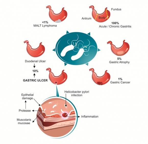Figure 3 : Mechanism of action/ Mechanism of resistance