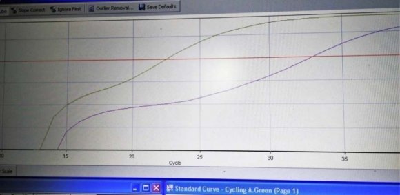 Figure 3 shows a linear increase in the density of current according to the time of contact of the electrode with the bacteria. This increase is represented by the line of equation: di = 0.0208 CT + 0.3478.