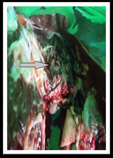 from Gilan province; Mir et al. 2008 from Kashmir and Khan et al. 2009 from Punjab Province (Pakistan) and by Phiri et al. 2005; Abunna et al. 2009; Fufa et al. 2009; Mwabonimana, et al. 2009. The predominance of Fasciola gigantica could be due to the availability of appropriate environmental conditions and topography (lowland and middle altitude zone) which are favorable habitat to its intermediate host L. natalensis (Urquhart et al. 1996).However, inverse distribution was reported by Melugeta et al. 2011; Belay et al. 2012; Chakiso, et al. 2014 and Alemu and Abebe 2015. Mixed infection of F.
