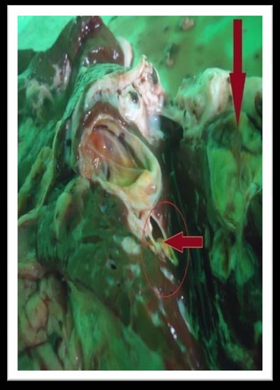 and F. gigantica occurs presumably as a result of the movement of stock between high and low ground or through overlapping of the territories of the snail vector at altitudinal range of 1200-1800 M.a.s.l.(Kendel  1954 andGraber, 1975).