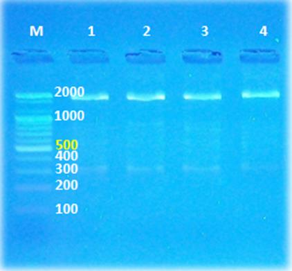 The objective of the current study is to identify the presence of intron 22 mutations in the non-coding FVIII gene of 10 gender-associated afflictions (hemophilic) Iraqi carrier kinship group by Polymerase Chain Reaction (PCR) through Multigene Optimax (Thermo Cycler) device, in addition to and direct sequencing in analyzing inversion. Intron 22 primer with 1916 base pairs generations indicated in figures no.(1),(2),(3) through the utilization of various differing programs for the mutations analysis that consist of NTI vector Pro., Clustal W technique of MEGA4 pro., NCBI/ BlAST program, Chromos Pro, Mutation Surveyor.