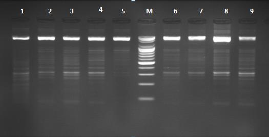 Figure 1: PCR products of FVIII gene on 2% agarose gel at 70 voltages for one hour. Intron22. Lane 1T: Lane-M-standard molecular weights: Lane 2, 3, 4, 5, 6, 7, 8, 9, 10, C, 11: Lane 12T. Gel was stained with Ethidium bromide staining.*C for carriers; T for control