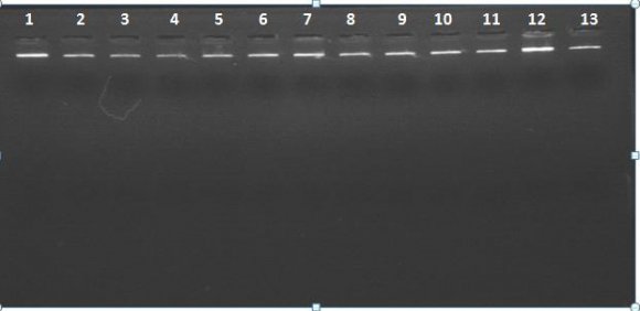 Figure 3: PCR products of FVIII gene on 2% agarose gel at 70 voltages for one hour. Intron22 -Lane-M-standard molecular weights: Lane 1T: Lane 2, 3, C. Gel was stained with SYBER Green staining. *C for carriers; T for control.