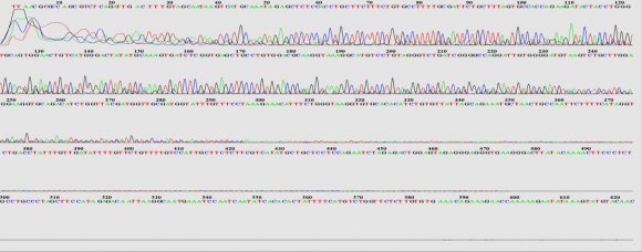 Figure 4: PCR products of FVIII gene on 2% agarose gel at 70 voltages for one hour.Intron22 Lane 1, 2, 3, 4, 5 C: Lane-M-standard molecular weights: Lane 6, 7, 8, 9 T. Gel was stained with Ethidiumbromide staining. *C for carriers; T for control.