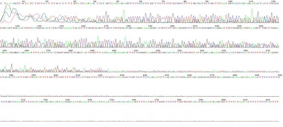 Figure 6: DNA sequencing (forward) for carrier no. 3 detect with Inv22.