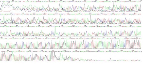 Figure 7: DNA sequencing (reverse) for carrier no. 3 detect with Inv22.Carrier no.7 appears in this study aligned was regarded as first carrier detect with intron 22 inversion of the FVIII gene reveal with positive family history and consanguinity state as showed in figures no(8,9).
