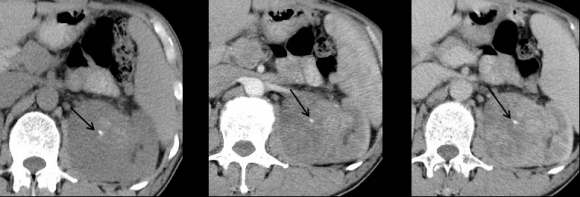 Shamim Ara ? , Noor mohammad ? , Sayed Ismail ? , De-xin Yu ? * & Xiang-xing Ma ¥ *