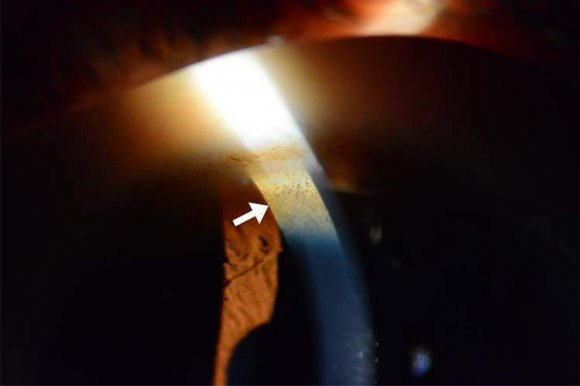 Figure 1: Physicians knowledge regarding lung cancer screening guideline and recommendation