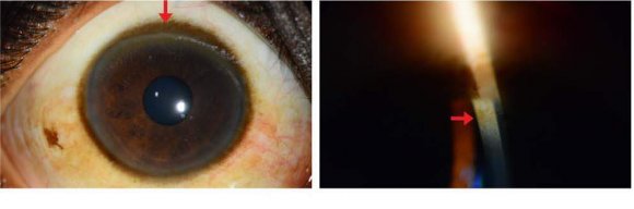 Peribulbar Blocks: The Experience of a Specialized Ophthalmologic Surgery Centre