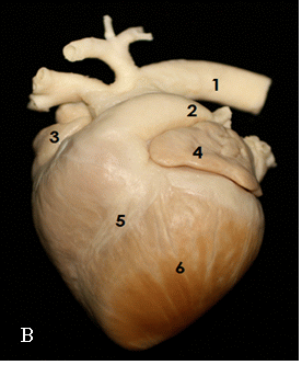 Fig.1: Heart A. 1: interventricular septum. 2. right ventricle. 3: papillary muscles. B. 1: aortic arch. 2: pulmonary artery. 3: right auricle. 4: left auricle. 5: paraconal groove. 6: left ventricle.