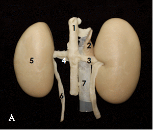 Fig.2: Kidney A. 1: decending aorta. 2: adrenal gland. 3: renal artery. 4: renal vein. 5: kidney. 6: ureter. 7: caudal vena cava. B. 1: renal pelvis. 2: renal cortex. 3: renal medulla.