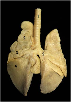 Fig.5: 1: pylorus. 2: left lobe of pancreas. 3: right lobe of pancreas. 4: duodenum.