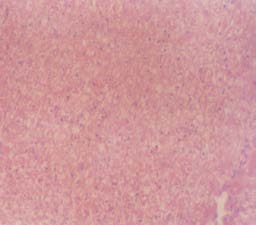 Fig. 1 : Liver of untreated (a) and saponin treated (b) rabbits.