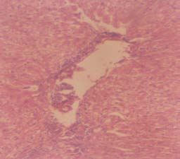 1. Adebayo, J. O., Yakubu, M. T., Egwin, E. C., Owoyele, B. V and Enaibe, B. U (2003). The effect of extract of Khaya senegalensis on some