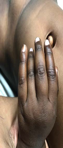 Figure 5: Showing serum B12 level