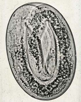 Trichostrongylidea and have direct life cycle; others belong to Metastrongylidea and, except F.osleri and C.aerophila have indirect life cycle. Diseases caused by the three Dictyocaulus species are of most economic importance. The cattle lungworm Dictyocaulus viviparous is common in Northwest Europe and is the cause of severe outbreaks of "husk" or "hoose" in young grazing cattle. The lungworm of sheep and goat, Dictyocaulus filarial is less pathogenic but does cause losses especially in Mediterranean countries, although it also recognized as a pathogen in Australia, Europe and North America. Dictyocaulus arnfeildi can cause severe coughing in horses and because patency is unusual in horse (but not in donkeys) differential diagnosis in disease due to other respiratory disease can be difficult. Mullarius capillariespresent worldwide and, while usually nonpathogenic in sheep, can cause severe signs in goats. Other lungworm infections generally cause occasional sporadic infection on many species in many countries(Fraser, 2000) 
