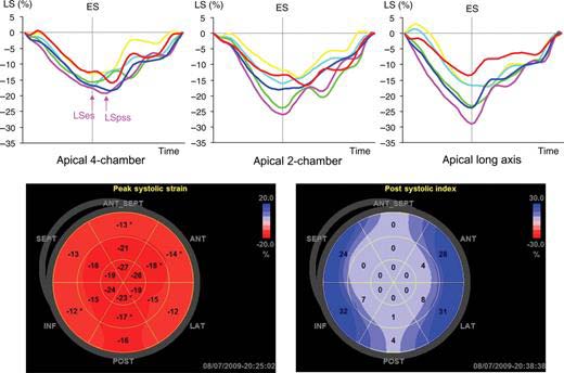 Figure 1: Fluoroscopic view showing the feeding tube in the stomach Author ?: MBBS, FRCSI, FICS, FACS, Consultant General and Laparoscopic Surgeon, Department of Surgical Specialties, NGH-Madinah-KSA. e-mail: abbasmoh@gmail.com Author ?: MBBS, Saudi Board, Consultant General and Laparoscopic Surgeon, Department of Surgical Specialties, NGH-Madinah-KSA. Author ?: MBBS, MRCSI, Associate Consultant General and Laparoscopic Surgeon, Department of Surgical Specialties, NGH-Madinah-KSA.