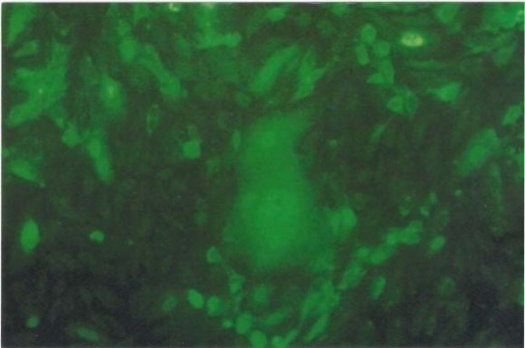 Figure 4BFigure 4: (A) Investigation of an archived FMDV stock virus (SV) RNA by SYBR Green RRT-PCR using PoF/PoR primers. SV dilutions 10 -1 -10 -8 , except 10 -3, illustrated variable C T values with PCR cycles. Two positive and negative controls, NTC, non-specific virus (BVD) and unknown samples were involved in the assay. Insets show melting curve analysis. (B) Screening of stock virus (SV) RNA with anticipated 422 bp. M: 100 bp ladder. Lanes 1-7: SV dilutions 10 -1 -10 -8 , except the missed dilution 10 -3 . Lane 8: positive control 2. Lanes 9-11, 16: unknown samples. Lanes 12-13: negative control 1 & 2, Lane 14: BVD, Lane 14: NTC