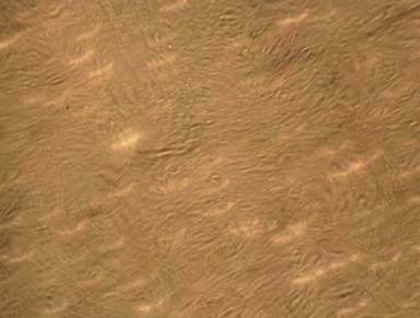 Fig. 8: Negative FAT carried out normal BHK21 cell culture (100Xs)