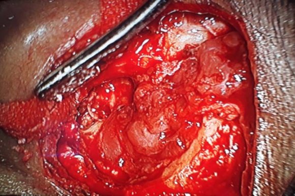 Fig. 1: Preoperative Frontal View of the Patient
