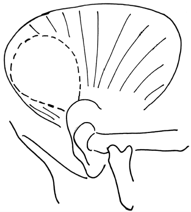 Fig. 2: Preoperative Intraoral View of the Patient