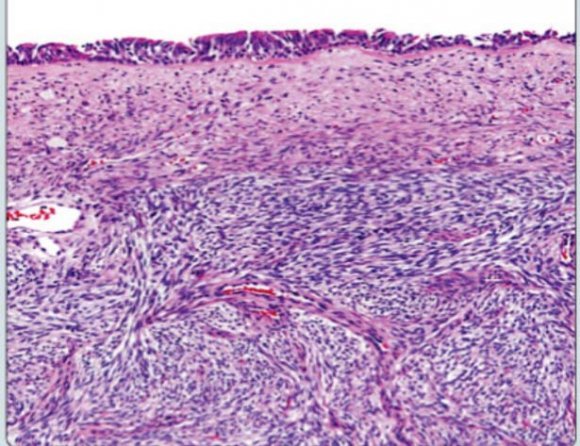 Fig. 2: En-Bloc Specimen of the Tumor.